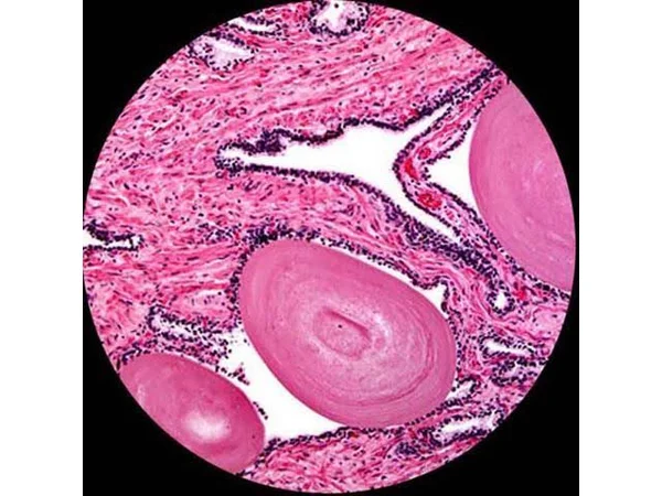 Amscope 40X-1000X Metal Frame Compound Microscope with 25 Prepared Slides
